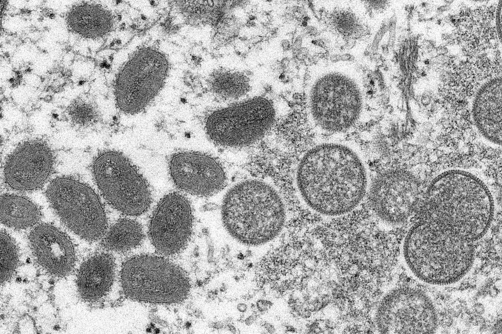 肯尼亚首例猴痘死亡病例引发关注，科技前沿助力抗疫，守护生命之光希望之光