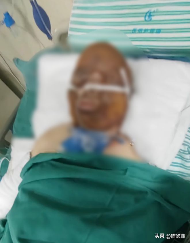 烧伤妈妈家属劝网友不再捐款，背后的温馨故事与秘密揭晓