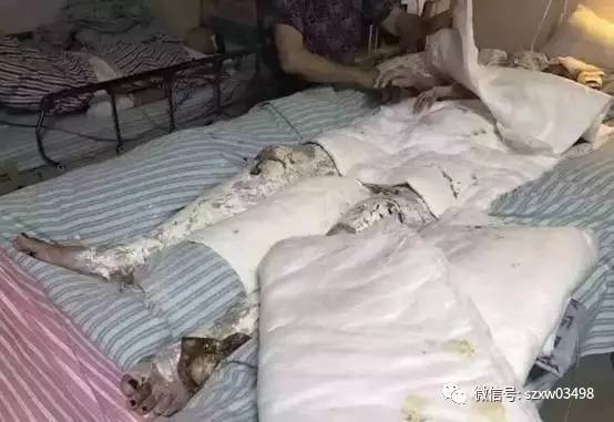 液化气泄漏意外背后的故事，厨房爆燃母子受伤，小巷独特小店的遭遇